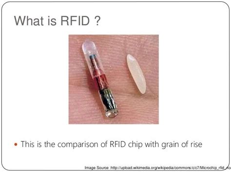 mri that shows rfid chips|rfid microchip uses.